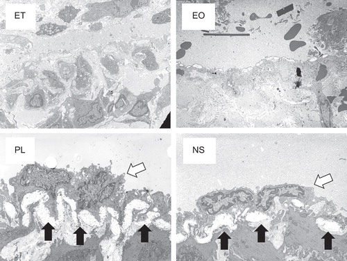 Figure 6. TEM findings of the femoral vein endothelium 7 days after the injection of sclerotic agents. The white arrows indicate endothelial cells and the black arrows indicate the endothelial basement membrane.