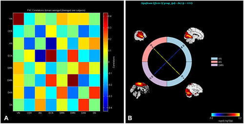 Figure 3 FNC correlations matrix (averaged over subjects) (A); the VN-AN and VN-SMN connections were found to be significantly altered between two groups (P < 0.01) (B).