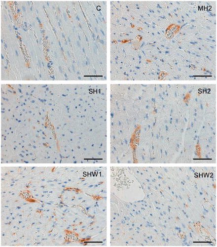 Figure 4. Thrombomodulin protein expression in rat heart tissue. Thrombomodulin immunohistochemical staining can be seen in the vascular endothelial cells of heart tissues (n = 12 per group); C, control; MH2, mild hypothermia 2; SH1, severe hypothermia 1; SH2, severe hypothermia 2; SHW1, severe hypothermia followed by rewarming at room temperature; SHW2, severe hypothermia followed by rewarming at + 28 °C; scale bar = 50 μm.