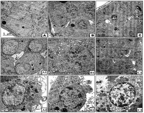 Figure 7. Transmission electron micrograph (TEM) through the seminiferous tubule of control (a-a2), diabetes (b-b2), diabetes with neem (c-c2). Note: In A &A1, the spermatogonia is showing normal nucleus (N), widely distributed mitochondria (M) with tight junction cell membrane. In B &B1, the spermatogenic cells are showing scattered vacuoles (V), highly condensed nucleus. In C&C1, the spermatogenic cells are showing remarkable amelioration in spite of moderate destruction of mitochondria and few vacuoles still present. In A1, the primary & secondary spermatocytes and spermatid are showing normal nucleus (N), mitochondria (M) and Golgi apparatus condensation over the nucleus of spermatid. In A2, the Leydig cell appears normal with homogenate cytoplasm and cell organelles. In B2, the Leydig cell is showing irregular nucleus membrane with peripherally accumulated chromatin, vacuolated cytoplasm, depleted mitochondria and wide cisterme rough endoplasmic reticulum. In C2, the Leydig cell is showing normal nucleus, oval mitochondria and rough endoplasmic reticulum (X: 3000)