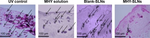 Figure 6 Fontana–Masson-stained sections of C57BL/6 skin from the UV control, MHY solution, and MHY-SLNs groups.