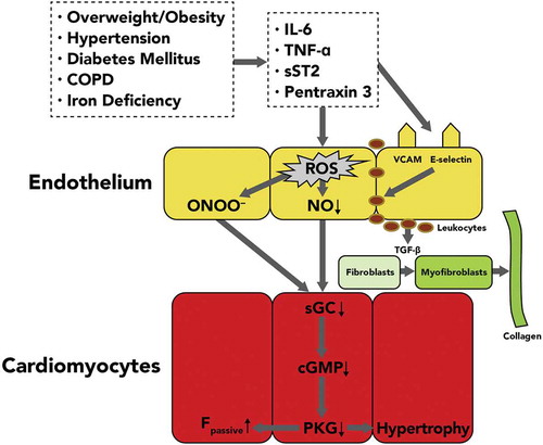 Figure 2. Schematic summary of the role of inflammation on the pathophysiology of HFpEF [Citation14]. Comorbidities, such as obesity, diabetes mellitus, COPD, and hypertension, contribute to a proinflammatory state that results in cardiac hypertrophy and diastolic dysfunction. Similarly, the upregulation of transforming growth factor β ultimately leads to collagen deposition in the interstitial space and diastolic dysfunction. The inflammatory pathway is getting more recognition as one of the pathways contributing to the pathophysiology of HFpEF. cGMP: cyclic guanosine monophosphate; Fpassive: resting tension; COPD: chronic obstructive pulmonary disease; IL-6: interleukin 6; NO: nitric oxide; ONOO: peroxynitrite; PKG: protein kinase G; ROS: reactive oxygen species; sGC: soluble guanylate cyclase; TGF-β: transforming growth factor β; TNF-α: tumor necrosis factor α; VCAM: vascular cell adhesion molecule. Reprinted from the Journal of the American College of Cardiology 62(4), Paulus WJ, Tschöpe C, A novel paradigm for heart failure with preserved ejection fraction: comorbidities drive myocardial dysfunction and remodeling through coronary microvascular endothelial inflammation, pg. 263–271, Copyright 2013, with permission from Elsevier