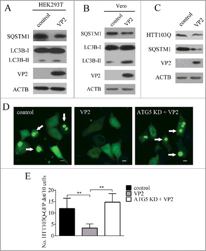 Figure 6. VP2 decreases aggregation of HTT103Q. (A) HEK293T cells and (B) Vero cells were transfected with empty vectors or pCMV-N-VP2 for 24 h. LC3B and SQSTM1 by were analyzed by western blot. ACTB was used as a sample loading control. (C) PK-15 cells were transfected with empty vectors or pCMV-EGFP-HTT103Q for 24 h. HTT103Q and SQSTM1 were analyzed by western blot. ACTB was used as a sample loading control. (D) PK-15 cells and ATG5 KD cells were co-transfected with pCMV-Flag-VP2 and pCMV-EGFP-HTT103Q for 24 h. The fluorescence signals were visualized by confocal immunofluorescence microscopy. Scale bars: 10 μm. (E) The number of HTT103Q dot was counted. The data represent the mean ± SD of 3 independent experiments. **P < 0.01.