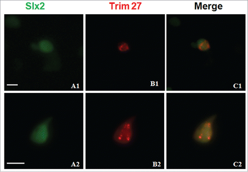 Figure 6. Subcellular localization of Trim27 and its influence on the distribution of Slx2 in HEK293T cells. Slx2-GFP is co-localized with Trim27-RFP in the nuclei of cells co-transfected with Slx2-GFP and Trim27-RFP fusion plasmids. The nuclei of cultured HEK293T cells are stained with DAPI, and images were captured using a laser confocal microscope. Upper panel: Trim27 (red), Slx2 (green) and nuclei (blue) at low magnification. Lower panel: Trim27 (red), Slx2 (green) and nuclei (blue) at high magnification. Bars = 10 μm.