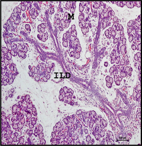 Figure 12. Photomicrograph of mandibular salivary gland of 40.5 cm CVRL (165th day) buffalo foetus showing typical tree-like branching pattern with well-developed intralobular ducts (ILD) (M-mucous cell). Haematoxylin and Eosin method×100.