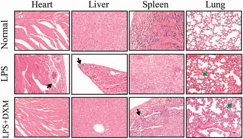 Figure 6. Morphology of the heart, liver, spleen and lung after intravenous injection of LPS (200× amplification). DXM: dexamethasone. Black arrow indicates the neutrophil infiltration and green arrow indicates alveolar secretion.