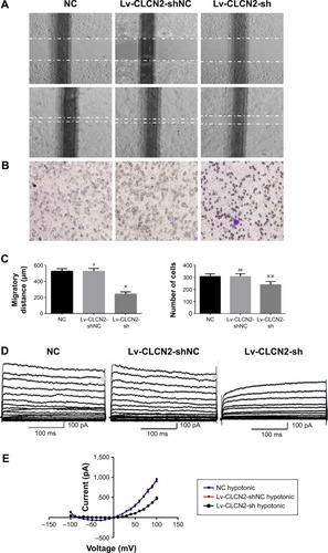 Figure 3 Lv-CLCN2-sh vector downregulated the migratory capacity of keratinocytes and volume-activated Cl− currents.