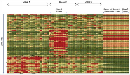 Figure 1. Heatmap generated from unsupervised hierarchical clustering analysis. 44 biopsy samples, 5 cell lines and 3 primary cells were aligned along the horizontal axis while genes were aligned along the vertical axis. The heatmap program generated groups 1–3 and we designated two classes of tumors, Class A and Class B.