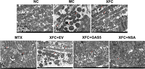 Figure 3 Effects of XFC on the ultrastructure of myocardial in AA rats (TEM, ×6000).