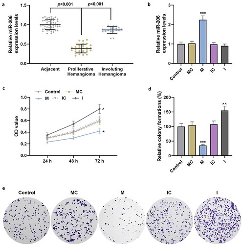 Figure 1. MiR-206 was down-regulated in proliferative hemangioma, but its up-regulation reduced the viability and proliferation of HemECs