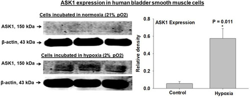 Figure 4 ASK1 expression was significantly upregulated in human bladder smooth muscle cells incubated under the hypoxic conditions at 2% pO2 in comparison with cells incubated in normoxia at 21% pO2. The data imply regulation of ASK1 by hypoxia, suggesting that decreased oxygen tension in bladder ischemia may be an important mediating factor in ASK1 upregulation. * represents significant change in the hypoxic smooth muscle cells versus cells in incubated in normoxia.