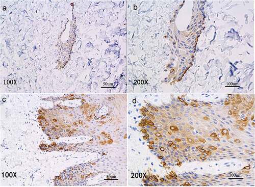 Figure 4. Immunohistochemical staining shows CK14 expression of CK14+EKCs in close contact with the biological scaffold (A, B) and with an arrangement similar to the basal cell layer of normal oral mucosal epithelium (C, D).