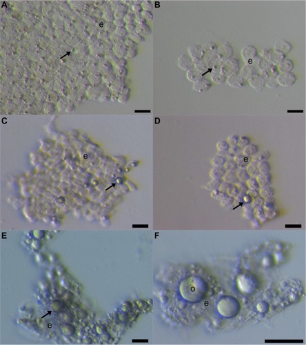 Figure 1 Small putative stem cells among epithelial cells after laparoscopic brushing of the ovarian surface epithelium in the same patient with premature ovarian failure and no naturally present follicles and oocytes.