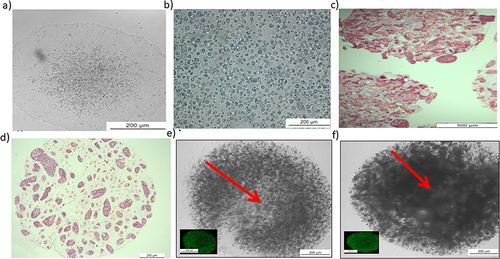 Figure 2 Characterization of human-induced pluripotent stem cells (IPSCs) before and after encapsulation.