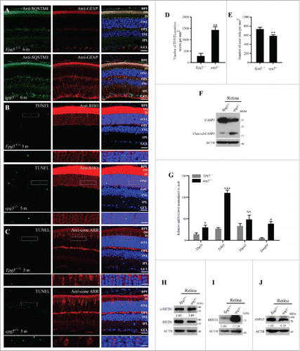 Figure 3. Photoreceptors undergo apoptosis and ER stress is activated in epg5−/− retinas. (A) Immunostaining analysis of cytoplasmic SQSTM1 and GFAP in the retinas of epg5−/− and Epg5+/− mice aged 6 mo. Few GFAP-stained structures are detected in Epg5+/− retinas, while many GFAP-stained tubular structures are observed throughout the retinas of epg5−/− mice. Scale bars: 20 µm. (B and C) TUNEL staining of 5-mo-old epg5−/− and Epg5+/− retinas that are costained with anti-RHO (rhodopsin) or anti-cone ARR/Arrestin antibodies. Scale bars: 20 µm. Enlargements of the boxed areas were shown on the bottom for each panel. Scale bars in enlargements: 60 µm. (D) Quantification of TUNEL-positive cells in retinas of epg5−/− and Epg5+/− mice. Means ± SEM of 6 paired mice at the age of 5 mo are shown. **P < 0.01. Statistical significance was determined by a 2-tailed, unpaired Student t test. (E) Quantification of anti-cone ARR-positive cones in epg5−/− and Epg5+/− mice at the age of 10 mo is shown in (E). Means ± SEM of 6 paired mice are shown. **P < 0.01. Statistical significance was determined by a 2-tailed, unpaired Student t test. Scale bars: 20 µm. (F) Immunoblotting analysis of full-length CASP3 and cleaved-CASP3 in retinas of epg5−/− and Epg5+/− mice at the age of 6 mo. Levels of cleaved CASP3 are dramatically increased in epg5−/− retinas compared with Epg5+/− retinas. (G) Transcriptional levels of genes involved in the UPR, including spliced Xbp1 (Xbp1s), Ddit3 and Eidj4, are significantly increased in epg5−/− retinas compared to controls at the age of 6 mo. *P < 0.05, ***P < 0.001. Data were compared with 2-tailed, unpaired Student t tests. (H, (I)and J) In epg5−/− retinas, DDIT3 and p-EIF2S1 protein levels are elevated, while the protein level of HSPA5, a downstream marker of the ATF6 pathway, is reduced.