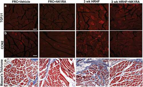 Figure 3. Representative images of TGFβ1 and CCN2 immunoreactivity, and Masson’s Trichrome staining, in cross-sectionally cut flexor digitorum muscles of FRC+Vehicle, FRC+NK1RA, untreated 3-week HRHF, and 3-week HRHF+NK1RA rats. (a) TGFβ1 immunoreactivity in flexor digitorum muscles. (b) CCN2 immunoreactivity in flexor digitorum muscles. (c) Masson’s Trichrome staining. Inset shows Masson’s Trichrome staining at higher power. Scale bars = 100 µm.