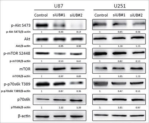 Figure 8. si-UBE2C inhibits the PI3K-Akt-mTOR signaling pathway in glioma cells. U87-MG and U251 cells were transiently transfected with si-UBE2C for 48 h, and the expression of phospho-Akt, phospho-mTOR and phospho-p70S6K1 was then analyzed by Western blot. β-Actin was used as a loading control.
