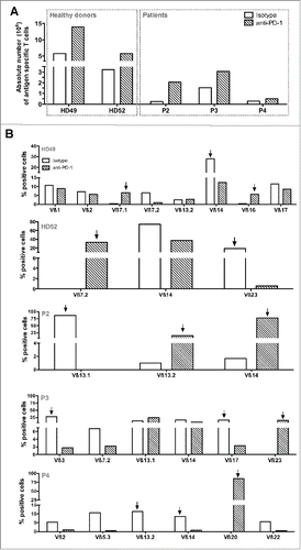 Figure 5. Amplification rates and Melan-A-specific T cell diversity in presence of anti-PD-1 blocking antibody. (A). Absolute number of Melan-A-specific T cells after the step of PBMC-peptide stimulation. 107 PBMC from HLA-A2 healthy donors and melanoma patients were stimulated in 96-well plates (2 × 105 cells/well) during 14 d with 1 μM of Melan-AA27Lpeptide, in presence of 10 μg/mL of anti-PD-1 Ab (hatched bars) or with 10 μg/mL of control IgG (white bars). At the end of the stimulation period, the absolute number of Melan-A-specific T cells was calculated from the total number of expanded T lymphocytes and the percentage of tetramer positive cells. (B). Analysis of the Vß repertoire of sorted and amplified Melan-A-specific T cells from stimulated PBMC. A panel of 24 anti-Vß antibodies was used. Empty histograms represent Melan-A-specific repertoire expanded in the control condition, and hatched histograms represent the repertoire amplified upon culture in the presence of anti-PD-1 Ab. Arrows indicate Vß subfamilies specifically amplified in one or the other of these two culture conditions, used for further analyses.