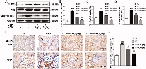 Figure 7. Effect of HQH on protein expression on the NLRP3 inflammatory pathway in the kidneys of CYP-treated rats. (A) The expression levels of NLRP3, ASC and Caspase-1 were determined by western blot representative images of protein bands were shown. (B) The levels of NLRP3. (C) The levels of ASC. (D) The levels of Caspase-1. (E) Immunohistochemistry analysis of NLRP3 and representative images were shown. Data are shown as mean ± SD, n = 4. ***p < 0.001 versus the Control group. ##p < 0.01 and ###p < 0.001 versus the CYP group.