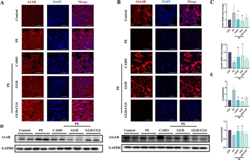 Figure 10. GGD blocked PE-induced expression changes of adenosine receptors. (A) Representative immunofluorescence images show A1AR (red) and DAPI (blue) (scale bar = 50 μm). (B) Representative immunofluorescence images show A2aAR (red) and DAPI (blue) (scale bar = 50 μm). (C) Quantification of A1AR and A2aAR mRNA expression. (D,E) Representative blots and quantification of A1AR and A2aAR protein expression. *p < 0.05 vs. Con; #p < 0.05 vs. PE.