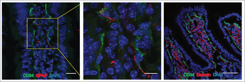 Figure 1. The Gut Vascular Unit. Confocal images of C57BL/6 mice intestine stained with CD34 (green) to identify blood endothelium and GFAP (red), marker of enteric glial cells (left panels; scale bars: 20 and 10 μm) or desmin (red) that marks perycites (scale bar 50 μm). In each section, nuclei were stained with DAPI (blue). Both cell types are in close proximity to CD34-positive endothelial cells, that together for the gut-vascular unit (GVU).