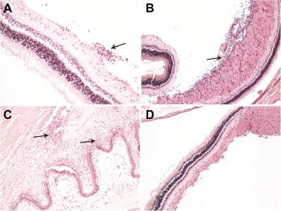 Figure 5 Light micrographs of 4μm thick sections stained with hematoxylin-eosin revealed chronic inflammatory infiltrations (A) especially in the nerve fiber layer of the retina around the optic disc (B) and in iris (C) in a few specimens. No other histological differences were evident between injected and noninjected eyes in the rest of the specimens (D).