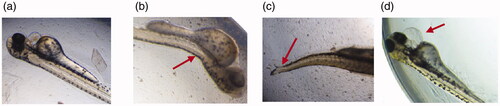 Figure 13. Malformations in zebrafish larva: (a) normal larva at 72 hpf, (b) spinal curvature, (c) scoliosis, (d) pericardial edema. Images were captured under magnification of 40×.