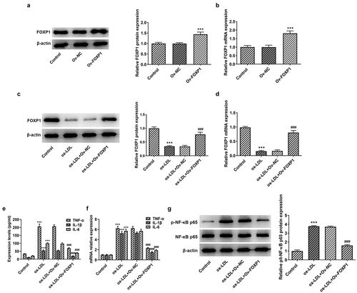 Figure 2. FOXP1 overexpression mitigated ox-LDL-induced inflammation in RAW264.7 cells. Measurement of FOXP1 (a) protein and (b) mRNA expression after FOXP1 overexpression in RAW264.7 cells with Western blot analysis and RT-qPCR. ***P < 0.001 vs. Ov-NC. Detection of FOXP1 (c) protein and (d) mRNA expression using Western blotting and RT-qPCR after FOXP1 overexpression in ox-LDL-stimulated RAW264.7 cells. TNF-α, IL-1β and IL-6 levels were examined by (e) ELISA kits and (f) RT-qPCR. (g) p-NF-κB p65 expression was tested with western bot analysis. ***P < 0.001 vs. control; ###P < 0.001 vs. ox-LDL+Ov-NC.