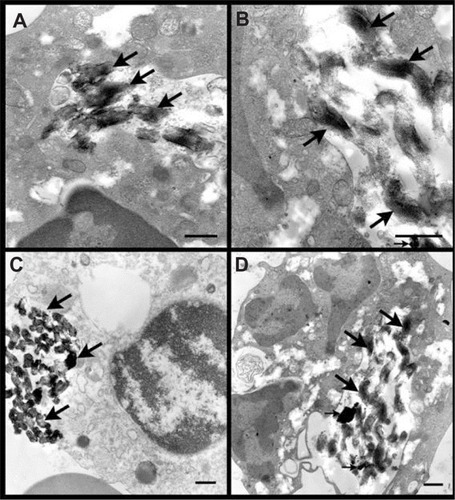 Figure 3 Transmission electron microscopic images of fetal blood mononuclear cells incubated with 500 μg/mL SBA15-cal for 2 hours. (A) Many SBA15-cal were seen within a vacuole in the cytosol of a macrophage without any obvious damage to any organelle (thick arrows). (B) Many SBA15-cal particles were seen within the cytosol of a macrophage and some of them were seen adherent to mitochondria without any obvious damage (thick arrow). (C) Many SBA15-cal were in the cytosol of a macrophage (thick arrow), in contact with a lysosome (thin arrow) without any evidence of phagosome-lysosome fusion. (D) Many SBA15-cal particles seen within a vacuole in the cytosol of a neutrophil polymorph, without any obvious damage to the organelles (thick arrows). Small arrows in (C) and (D) indicate artifacts.Note: Scale bar = 0.5 μm.