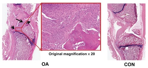 Figure 6 Representative histological sections of osteoarthritis (OA group) and normal (CON group) knee joints (black arrowheads in the ×20 magnification of the OA section show bone erosion, inflammation, pannus formation, and synovial hypertrophy).