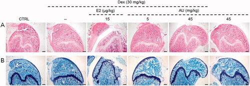 Figure 3. The effects of AU on the femoral histology of OP mice, as detected by (A) haematoxylin and eosin staining (40×) (Scale Bar: 200 μm) and (B) Giemsa staining (40×) (Scale Bar: 200 μm) (n = 6). CTRL: control; Dex: dexamethasone; E2: oestradiol; AU: aucubin.