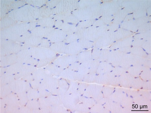 Figure 1 In the micrograph of the control group, brown staining is observed in a small number of cells showing immunoreaction by TUNEL staining. Magnifi cation: ×400.