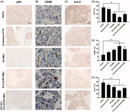 Figure 8. Immunohistochemical studies. Qualification of expression of (A) p53, (B) CD86 and (C) bcl-2 within the tumor tissues of mice after different treatments. Quantification of expression of (D) p53, (E) CD86 and (F) bcl-2 within the tumor tissues of mice after different treatments. n = 4, **p < .01. The bar is 100 μm.
