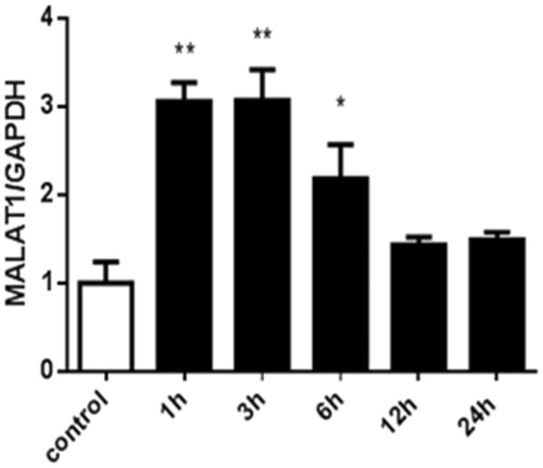 Figure 3. The expression of MALAT1 in HK2 cells at different time points after CoCl2 treatment. HK2 cells were treated with normal medium or 200 µmol/L of CoCl2 for various durations. The expression of MALAT1 was analyzed by RT-PCR, and the ratio of MALAT1/GAPDH was normalized to the control group. Data are representative of three independent experiments performed in triplicate. *p < .05 vs the control group; **p < .01 vs the control group.