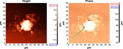 Figure 3 Ehrlich carcinoma cell.Notes: AFM (left), MFM (right). Data from Chekchun et al.Citation21 MFM shows BMNPs in the form of dark spots arranged in chains (arrow).Abbreviations: AFM, atomic force microscopy; MFM, magnetic force microscopy; BMNPs, biogenic magnetic nanoparticles.