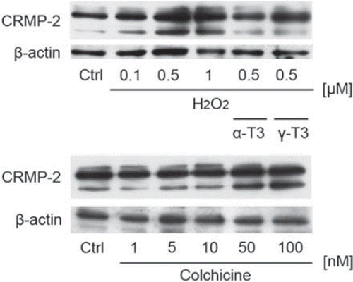 Figure 4. Denatured CRMP-2 proteins appeared after treatment of CGCs with hydrogen peroxide. CGCs after treatment with hydrogen peroxide in the presence or absence of α-tocotrienol (5 μM) or γ-tocotrienol (5 μM) were lysed and used for Western blotting analysis. The same membranes were reprobed and used for the detection of β-actin (A). CGCs were treated with various concentrations of colchicine (B). After 24 h, the cells were lysed and used for Western blotting. Each data represents the mean of three independent experiments.