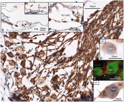 Figure 6. Immunohistochemistry of the human cochlea in a temporal bone obtained at autopsy. A: There is a strong expression of Na/K-ATPase α3 subunit in the spiral ganglion cell bodies, membrane, and nerve fibers. Both type I and type II cells (D) are positive. B: There is a high expression of α3 in the spiral lamina fibers and neurons beneath the IHCs and OHCs. Basal tunnel fibers (BTF-afferents) (inset in B) and efferent tunnel-crossing fibers (TCFs) (C) also express the α3 subunit. E: α1 is intensively expressed in the satellite glial cells at the axon hillock region using CM F: Corresponding type I cell shows α3 expression in the neuron at the axon hillock. OSB: outer spiral bundle; TM: tectorial membrane.