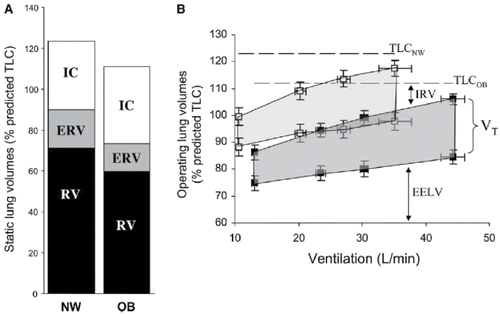 Figure 2. (A) Static lung volumes measured by body plethysmography at rest. Expiratory reserve volume (ERV) and functional residual capacity (FRC) (ERV + RV) were significantly (p < 0.05) lower in the obese (OB) group. (B) Lung volumes are shown from rest to peak exercise in OB patients COPD (closed squares) and in normal weight (NW) patients with COPD (open squares). In the OB compared with the NW group, end-expiratory lung volume (EELV) (standardized as a % of predicted TLC) was consistently lower (*p < 0.01) at rest and throughout exercise; the OB group reached an EELV at peak exercise that was similar to that of the NW group at the pre-exercise resting level. IC = inspiratory capacity; IRV = inspiratory reserve volume; VT = tidal volume (shaded area); RV = residual volume. Values are means ± SE. Reproduced from Ora J, Laveneziana P, Ofir D, Deesomchok A, Webb KA and O'Donnell DE. Combined effects of obesity and chronic obstructive pulmonary disease on dyspnea and exercise tolerance. Am J Respir Crit Care Med. 2009;180(10):964–71. Reprinted with permission of the American Thoracic Society. Copyright © 2017.