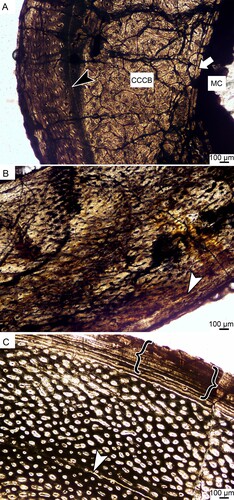FIGURE 3. Osteohistology of three Megapnosaurus rhodesiensis tibiae from the Lower Jurassic of South Africa. A, BPI008, showing compacted coarse cancellous bone before a LAG (black arrow head) and a WPC after to the subperiosteal surface. A thin layer of endosteal bone (white arrow) is present close to the medullary cavity. No OCL is present indicating the individual had not reached maximum size; B, BP/1/6614, showing a WPC with longitudinally oriented primary osteons and circular and radial vascular canals. One LAG is present in the outer cortex (white arrowhead); C, BPI001, showing a WPC with longitudinally oriented primary osteons. An OCL (black brackets) at the sub-periosteal surface indicates that the individual had reached maximum size. The white arrowhead indicates a mid-cortical LAG. Abbreviation: CCCB, compacted coarse cancellous bone; MC, medullary cavity.