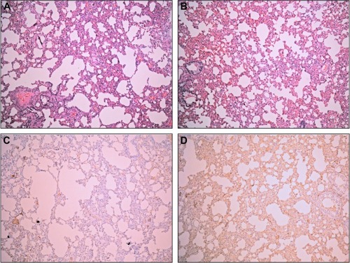 Figure 3 The effect of alpinetin on lung tissue in pancreatitis-associated lung injury.