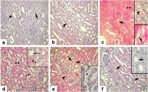 Figure 4. a) Sham group, regular morphology of renal glomerulus (arrowhead) and tubulus (arrow); b) Splx group, similar morphology with sham group with regular tubulus structure (arrow); c) IR group, severe medullary congestion and interstitial edema (**) besides prominent vacuolization in the cytoplasm of the tubule cells (inset, arrowhead), tubular degeneration (arrows); d) IR + Splx group, reduced edema and congestion (**), regenerated tubular cells (arrows), and partial tubular degeneration (inset-arrowhead); e) IR + Gd group, regenerated tubular cells and note the regressed profile of cellular vacuolization (inset-*), decreased and limited medullary congestion (arrowheads); f) IR + Splx+ Gd group, prominent regeneration of tissue with regular tubules (arrows) (note the regular morphology of proximal tubulus, inset-arrow). HE stain, magnification × 200, insets × 400.