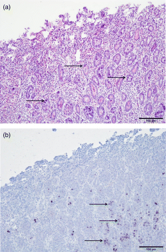 Figure 2.  Histopathological lesions of the gizzard from an affected broiler. 2a: Erosion of gizzard epithelial cells and infiltration of inflammatory cells in the mucosal membrane. Basophilic intranuclear inclusion bodies can be observed in gizzard epithelial cells (arrows). Haematoxylin and eosin staining. Bar = 100 µm. 2b: In-situ hybridization of gizzard sample. Positive reaction of inclusion bodies with FAdV-1 DNA (arrows). Bar = 100 µm.