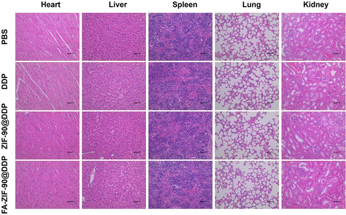 Figure 6 Effects of FA-ZIF-90@DDP on major organs. H&E staining of major organs of A2780/DDP hormonal mice after 14 days of different treatments (Scale bar = 50 µm).