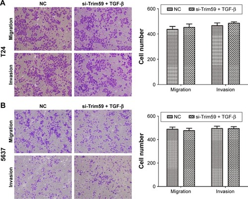 Figure 5 TGF-β promotes cell migration and invasion in Bca cell lines.