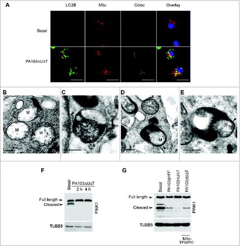 Figure 2. Infected BMDMs undergo mitophagy. (A) Representative confocal images of BMDMs infected with PA103ΔUΔT (MOI 25 for 4 h) and stained for LC3B (green), and mitochondrial ATPIF1 (Mito, red); nuclei are stained blue with DAPI. Coloc shows areas of colocalization of the mitochondrial and LC3B staining in gray. Overlay shows the merged LC3B and mitochondrial signals; colocalizing areas shown as yellow. Scale bar = 5 μm. Repeated 3 times. ((B)to E) Electron micrographs of autophagosomes of untreated BMDM (B) or infected with PA103ΔUΔT(MOI 25) for 4 h (C) to (E). Arrowhead indicates autophagosome with enclosing double membrane, M indicate mitochondria. Scale bar is 500 nm. Representative image from > 10 infected cells. (F) Immunoblot of BMDMs infected at a MOI of 25 with PA103ΔUΔT for the indicated times probed for PINK1. Full-length and cleaved PINK1 are labeled. The blot was reprobed for TUBB5 as a loading control. (G) As (F) but with infections and treatments as shown and is representative of 2 independent experiments.