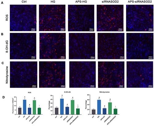 Figure 3 APS reduced ROS formation and oxidative damage in H9C2 cells. (A) ROS formation in Fluorescence microphotographs showing DHE-stained positive (red) cells. (B) Fluorescence microphotographs showing 8-OH-dG-stained positive (red) cells. (C) Fluorescence microphotographs showing nitrotyrosine-stained positive (red) cells. (×200 magnification). (D) Bar graph showing the ROS formation and the intensity of 8-OH-dG and nitrotyrosine signals in cultured H9C2 cells. Values are presented as mean ± SEM. The two-group analysis was performed using the independent samples t-test between HG and ctrl, siRNASOD2 and ctrl, APS-HG and HG, APS-siRNASOD2 and siRNASOD2. *P<0.05 vs ctrl, #P<0.05 vs HG, and !P<0.05 vs siRNASOD2, corresponding to all the repetitions in the study.