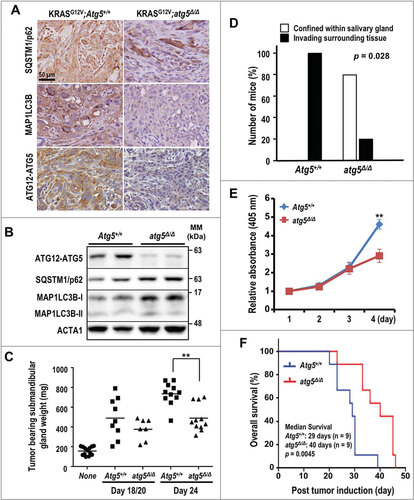 Figure 1. Enhanced survival of autophagy-deficient KRASGCitation12V;atg5∆/∆ mice. (A) Representative IHC of SQSTM1, LC3B and ATG12–ATG5 in SDC tumors from KRASGCitation12V;Atg5+/+ and KRASGCitation12V;atg5∆/∆ mice (d 15). The SDC tumors from KRASGCitation12V;atg5∆/∆ mice (d 15) show the loss of ATG12–ATG5 and LC3B staining in tumor cells. Scale bar: 50 µm. (B) Western analyses of lysate of SDC tumors recovered from KRASGCitation12V;Atg5+/+ and KRASGCitation12V;atg5∆/∆ mice with the indicated antibodies. (C) Increased tumor burden in KRASGCitation12V;Atg5+/+ mice. Submandibular glands from KRASGCitation12V;Atg5+/+ and KRASGCitation12V;atg5∆/∆ mice were harvested at d 18 and 20 (d 18/20 combined group), and d 24 post-tamoxifen and wet weights were recorded. Submandibular glands from untreated littermates serve as controls and are designated as “none”. p = 0.0045 between KRASGCitation12V;Atg5+/+ and KRASGCitation12V;atg5∆/∆ cohorts at d 24 (n ≥ 7). (D) Extra-salivary-gland invasion in the KRASGCitation12V;Atg5+/+ cohort at d 20 (p = 0.028, n = 5). (E) Autophagy promotes cell growth in vitro. In vitro cell growth analysis was performed by seeding KRASGCitation12V;Atg5+/+ and KRASGCitation12V;atg5∆/∆ primary tumor cells at low density and measuring viability every 24 h for 4 consecutive d by ACP analysis. **: p < 0.01. (F) The Kaplan-Meier survival curves for KRASGCitation12V;Atg5+/+ and KRASGCitation12V;atg5∆/∆ mice after tumor induction by tamoxifen (n = 9 for each cohort). p = 0.0045 (log-rank test)