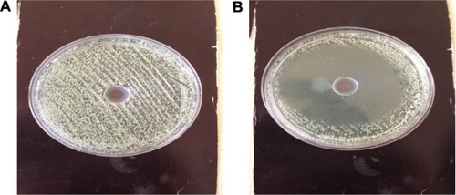 Figure 5 Zones caused by the formulations on G-MB-MHA medium (A) N16, (B) N19.Abbreviation: G-MB-MHA, glucose- and methylene blue-added Mueller-Hinton Agar.