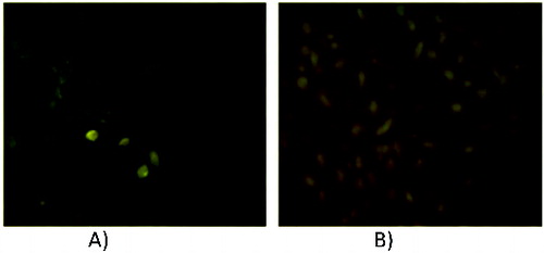 Figure 5. Fluorescence micrographs of MDCK II (A) and RPE-1 (B) cells after incubation with 1.5 × 10−6 mol L−1 ANS-labelled sPLA2.