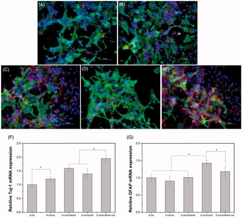 Figure 8. Qualitative and quantitative measurement of NSCs differentiation. Immunocytochemical staining of differentiated neurons and astrocytes on pure PLGA nanofibres (A), PLGA/GO nanofibres (B), PLGA/GO/BDNF nanofibres (C), PLGA/GO/IGF nanofibres (D), and PLGA/GO/IGF + BDNF nanofibres (E). Immunostaining makers are Tuj-1 for neurons, GFAP for astrocytes and DAPI for nuclei. The Scale bar was 100 µm. Quantitative real-time PCR analysis of Tuj-1 (F) and GFAP (G) after NSCs cultured for 7 days. (∗, p < .05, n = 4).